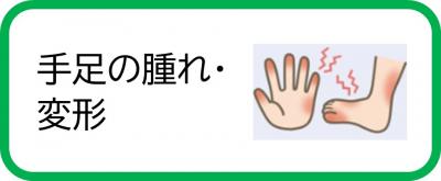 手足の腫れ・変形